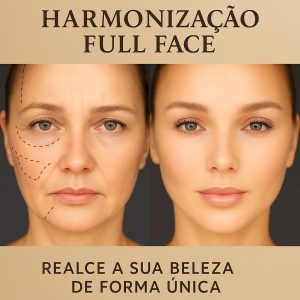 Preenchimento Facial (1ml)